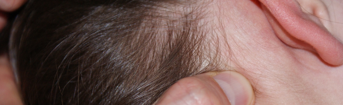 Tuina (medizinische Massage) — AcuSanté, Estavayer-le-Lac